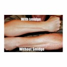 Smidge knott- og myggmiddel UTSOLGT FOR SESONGEN! thumbnail